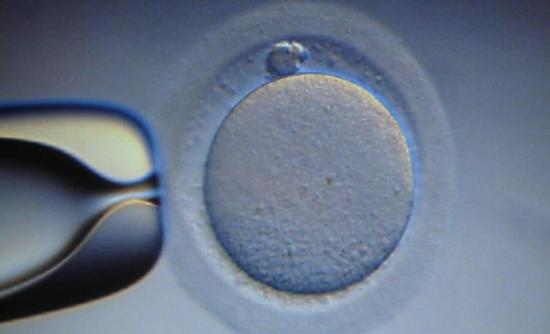 Ιταλός γενετιστής κατηγορείται ότι έκλεψε ωάρια από ασθενή του