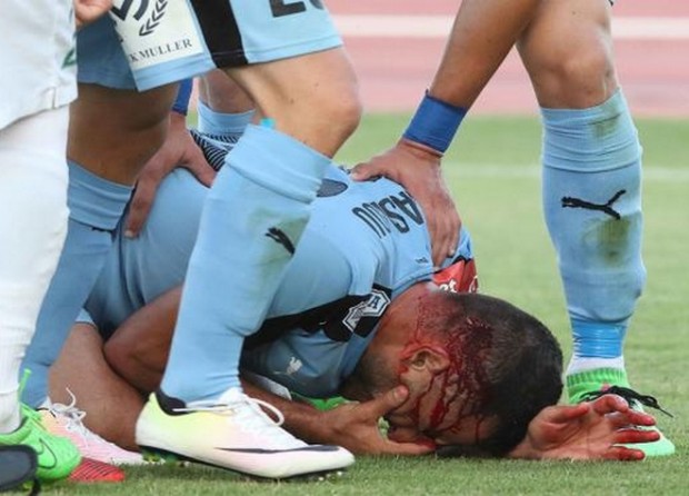 Επεισόδια στον τελικό του Κυπέλλου Κύπρου, τραυματίστηκε και ποδοσφαιριστής – ΒΙΝΤΕΟ