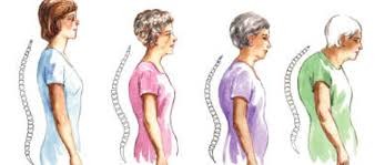 Kατάγματα λόγω οστεοπόρωσης: Πότε συμβαίνουν πώς να τα αποφύγετε