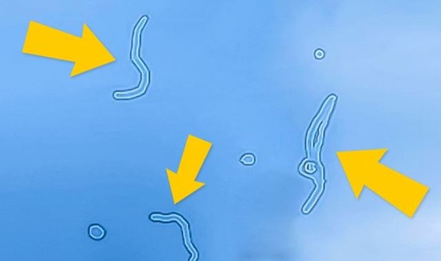 Τι είναι τα σημάδια που βλέπετε καμιά φορά να… αιωρούνται στα μάτια σας – ΒΙΝΤΕΟ