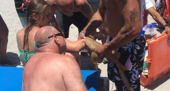 Πήγε στο νοσοκομείο με τον μικρό καρχαρία “καρφωμένο” στο χέρι της – ΦΩΤΟ