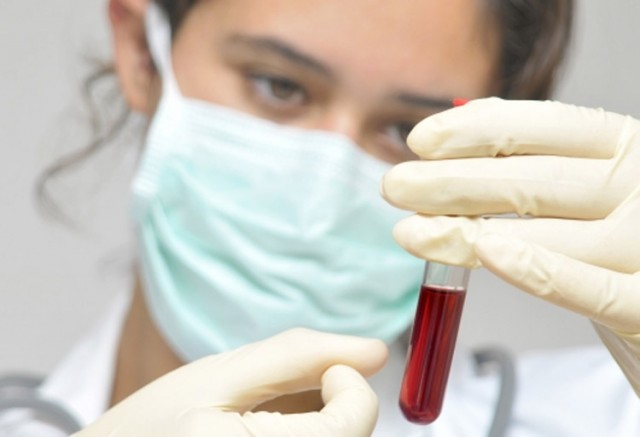 Eξέταση αίματος “προβλέπει” το έμφραγμα πέντε χρόνια πριν συμβεί