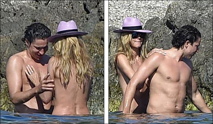 Η Χάιντι Κλουμ έκανε ηλιοθεραπεία topless – ΦΩΤΟ