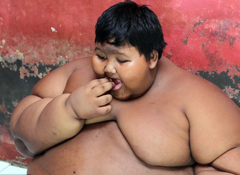 Η συγκινητική ιστορία ενός 10χρονου που ζυγίζει 192 κιλά – ΦΩΤΟ – ΒΙΝΤΕΟ