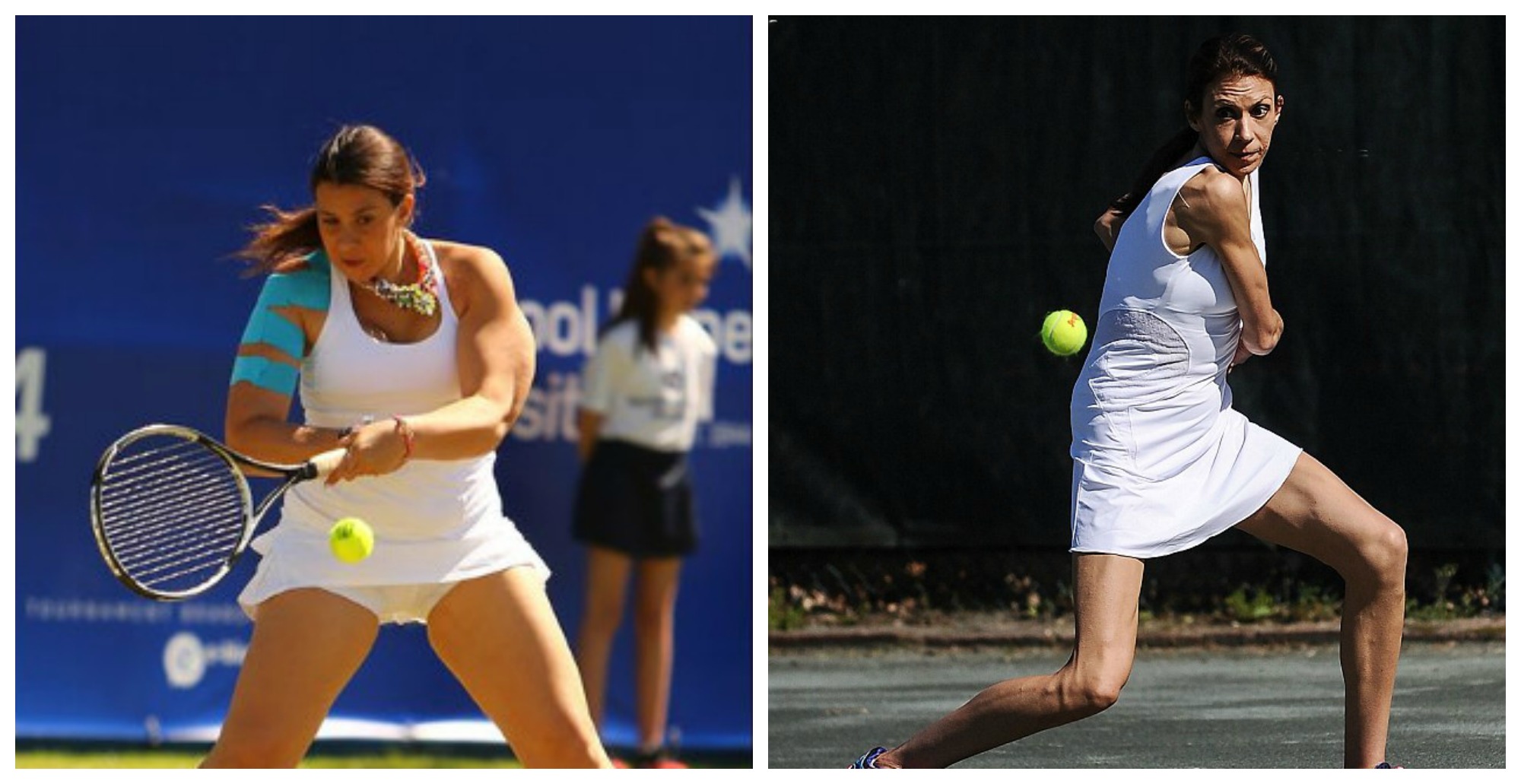 Ανησυχία για την υγεία της κορυφαίας Γαλλίδας τενίστριας – ΦΩΤΟ