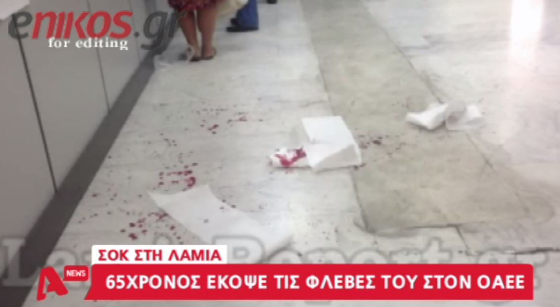 «Γι αυτό έκοψα τις φλέβες μου στον ΟΑΕΕ» – ΒΙΝΤΕΟ