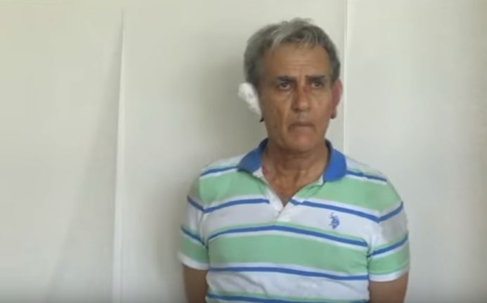 Οι μελανιές στο πρόσωπο του συλληφθέντα στρατηγού της Τουρκίας – ΒΙΝΤΕΟ