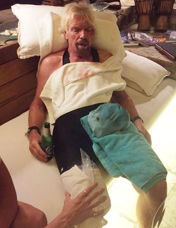Sir Richard Branson after he was involved in an accident when he crashed his bicycle