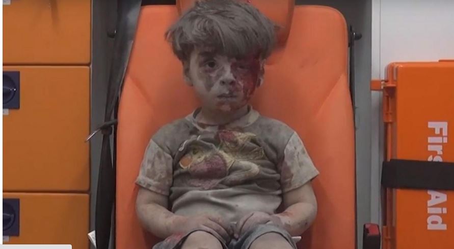 Υπέκυψε στα τραύματά του ο αδελφός του μικρού Ομράν