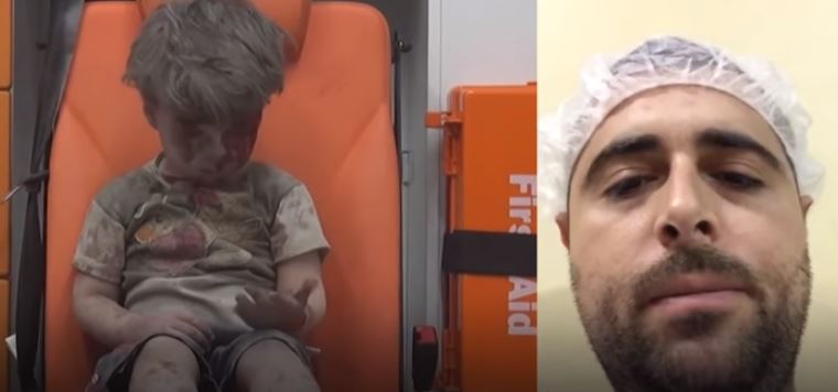 Σύρος χειρουργός για τον μικρό Ομράν: Είναι τυχερός γιατί βρέθηκε κάποιος να τον βοηθήσει – ΒΙΝΤΕΟ