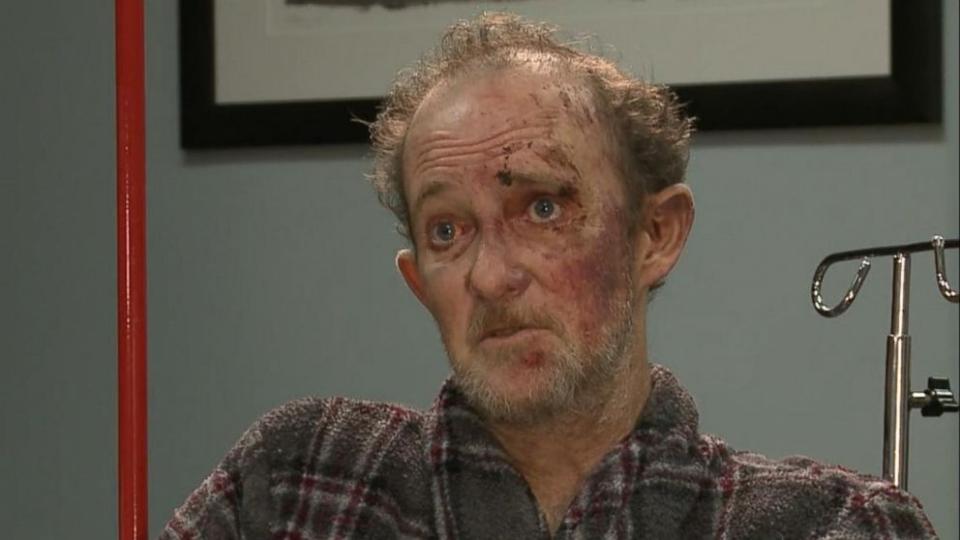 ΗΠΑ – Ασύλληπτο τροχαίο – Τυχερός ο οδηγός – ΒΙΝΤΕΟ