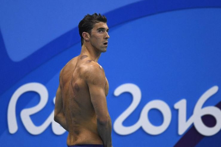 Σάλος με τους κόκκινους κύκλους στο δέρμα του Φελπς – Τι συμβαίνει με τον Ολυμπιονίκη;