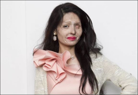 Θύμα επίθεσης με οξύ, η βασίλισσα της πασαρέλας στη Νέα Υόρκη