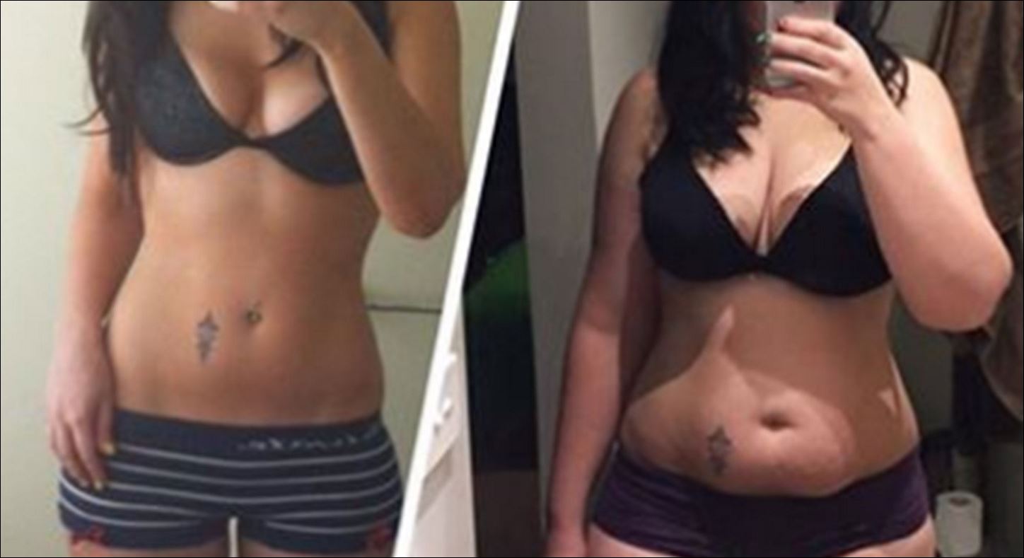 Το μήνυμα για το γυναικείο σώμα μετά την εγκυμοσύνη που έγινε viral