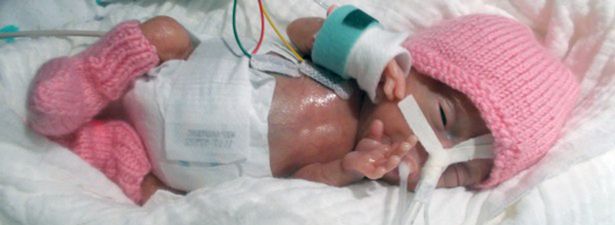 Emilia, the smallest premature baby in the world