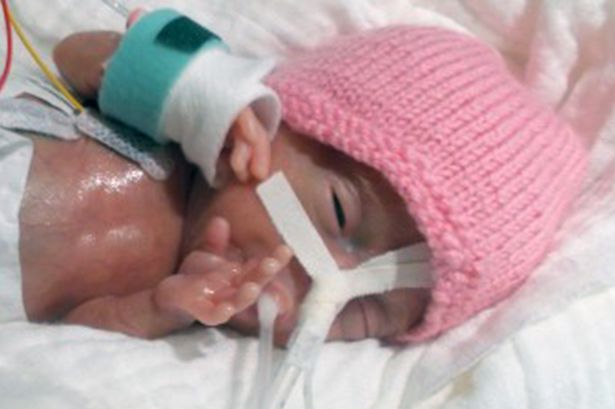 Emilia, the smallest premature baby in the world