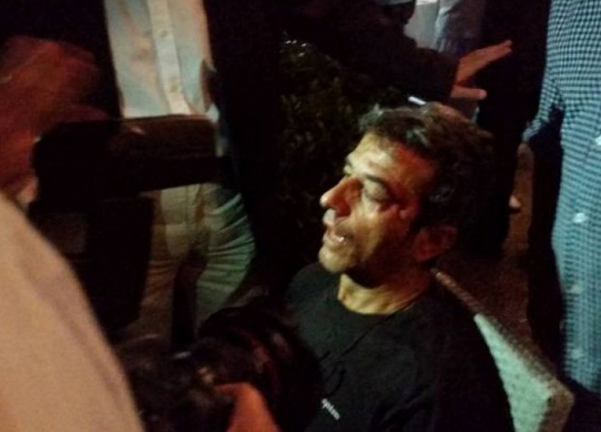 Ντου κουκουλοφόρων στην κλήρωση της Football League – Tραυματίστηκε ένας φωτορεπόρτερ