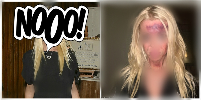 Σοκάρει η φωτογραφία που ανέβασε 40χρονη ηθοποιός στο Instagram