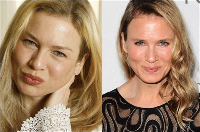 Η Ρενέ Ζελβέγκερ εξηγεί γιατί το πρόσωπό της δείχνει διαφορετικό