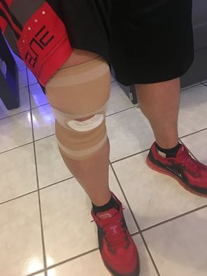 Η περιπέτεια υγείας του Μάριου Γεωργιάδη – ΦΩΤΟ