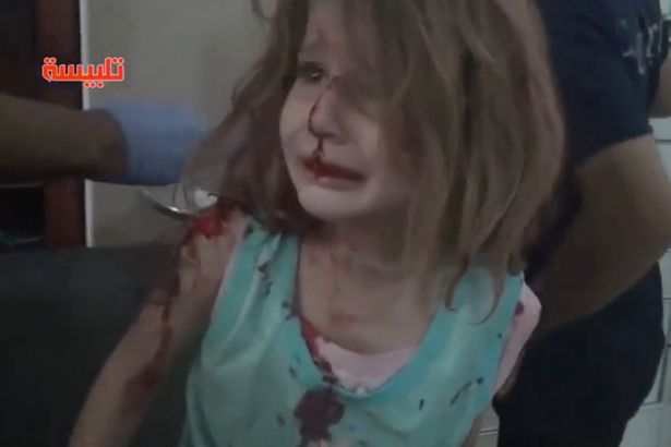 Εικόνες που συγκλονίζουν από τη Συρία – Τραυματισμένο κοριτσάκι ψάχνει τον πατέρα της