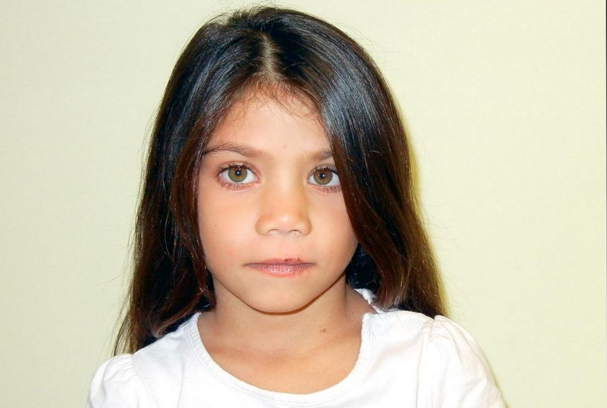 Η ΕΛ.ΑΣ για το 6χρονο κορίτσι στον οικισμό των Ρομά: “Μήπως την γνωρίζετε;”
