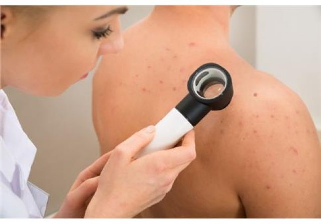 Γιατί η ψωρίαση δεν είναι μόνο μια πάθηση του δέρματος