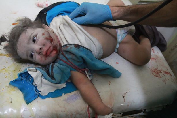 Το Χαλέπι εκπέμπει SOS – Βρέφη και παιδιά πιο κοντά στον θάνατο λόγω του υποσιτισμού