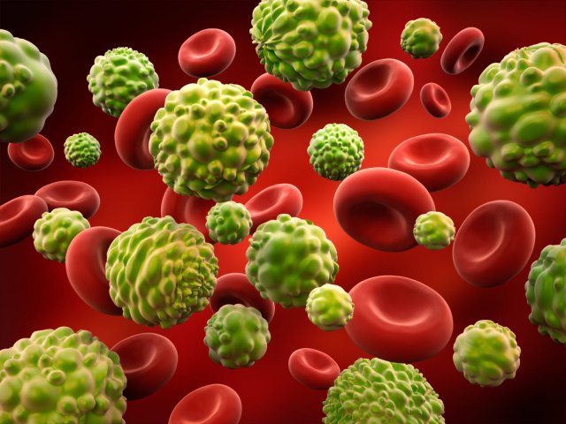 Είναι ο καρκίνος κληρονομικός;