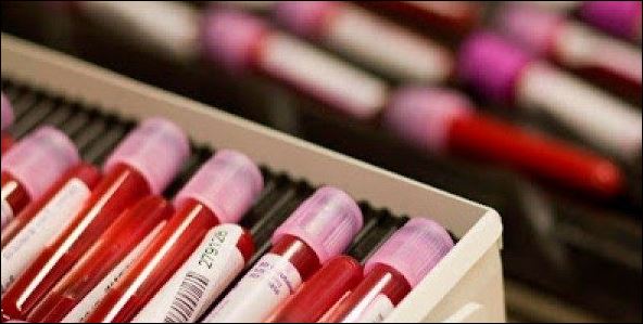 Δείτε τι ξεχωριστό έχουν οι άνθρωποι με ομάδα αίματος 0