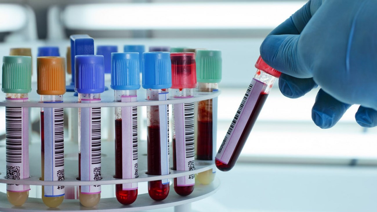Τεστ αίματος ανιχνεύει σε ποιο σημείο αναπτύσσεται ο καρκίνος