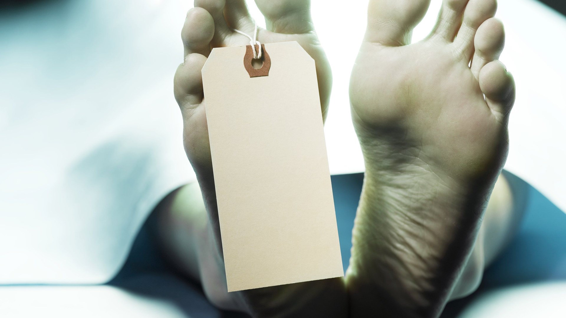 Μελέτη που σοκάρει – Ο εγκέφαλός μας μπορεί να λειτουργεί και 10 λεπτά μετά τον θάνατο