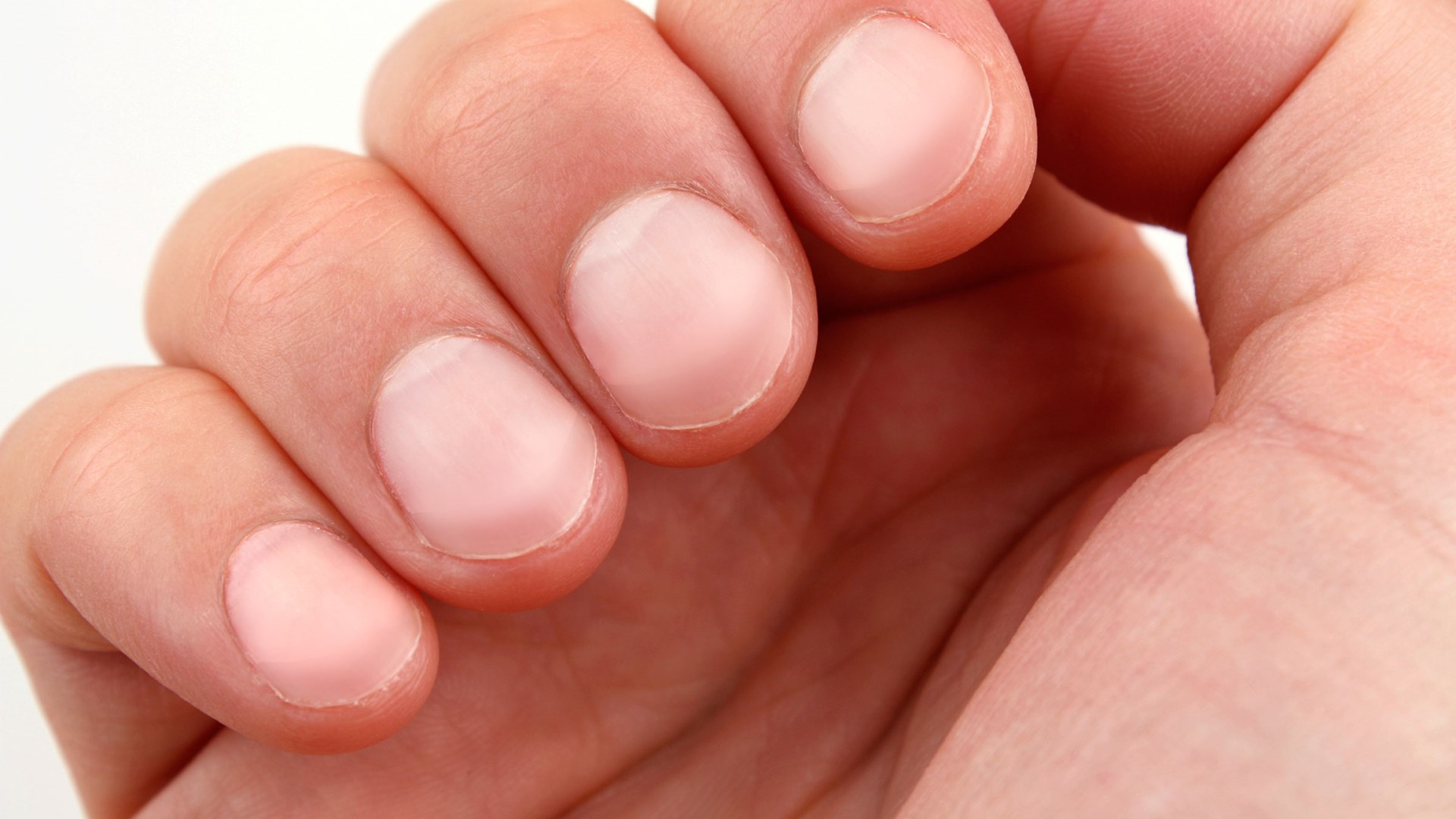 Τι σημαίνουν τα λευκά σημάδια στα νύχια μας – Πρέπει να ανησυχήσουμε; – ΒΙΝΤΕΟ
