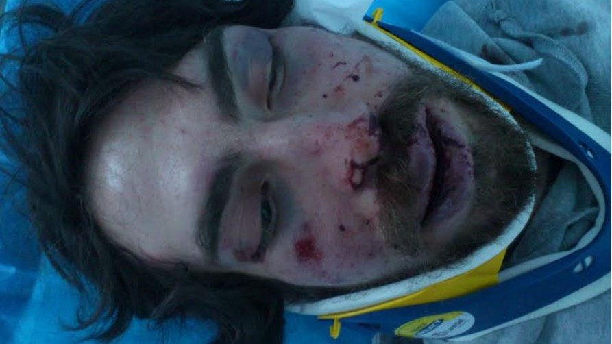 Άγριος ξυλοδαρμός φοιτητή από τάγμα εφόδου της Χρυσής Αυγής – Σκληρές εικόνες