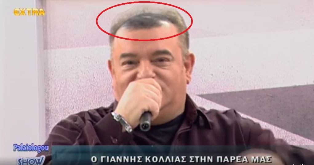 Όταν το σπρέι βαφής μαλλιών γίνεται μόδα… – ΒΙΝΤΕΟ