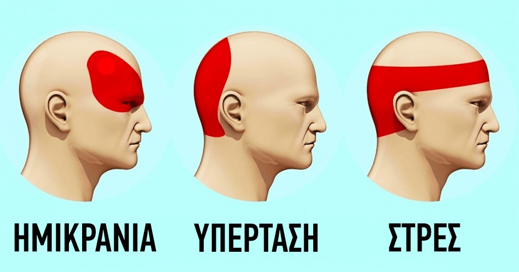 Δείτε πώς θα ξεφορτωθείτε τους πονοκεφάλους σε 5 λεπτά χωρίς χάπια