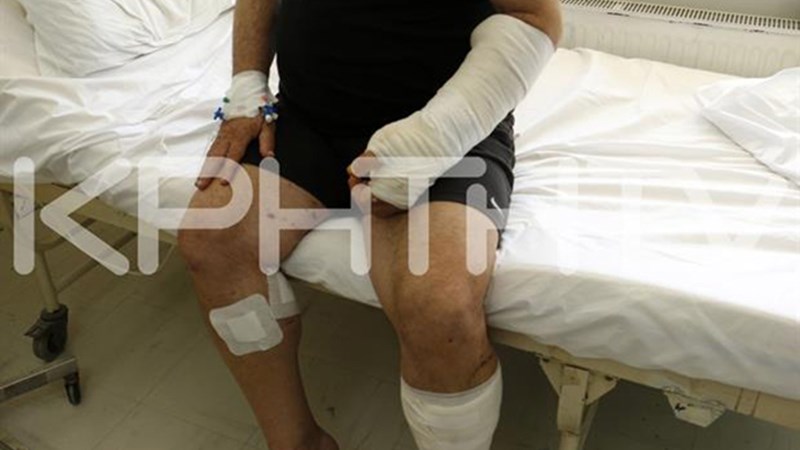 Έκανε 160 ράμματα στο κεφάλι από επίθεση πίτμπουλ – ΣΚΛΗΡΕΣ ΕΙΚΟΝΕΣ