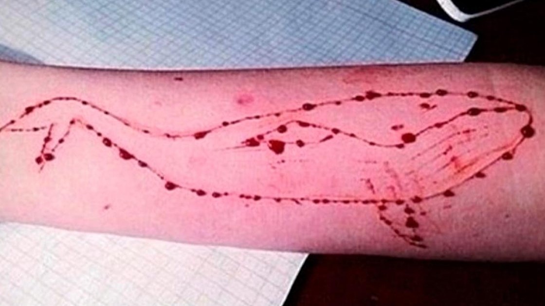 Ανησυχία για νέο περιστατικό της “μπλε φάλαινας” – Η γρατζουνιά σε 9χρονη που αναστάτωσε το σχολείο