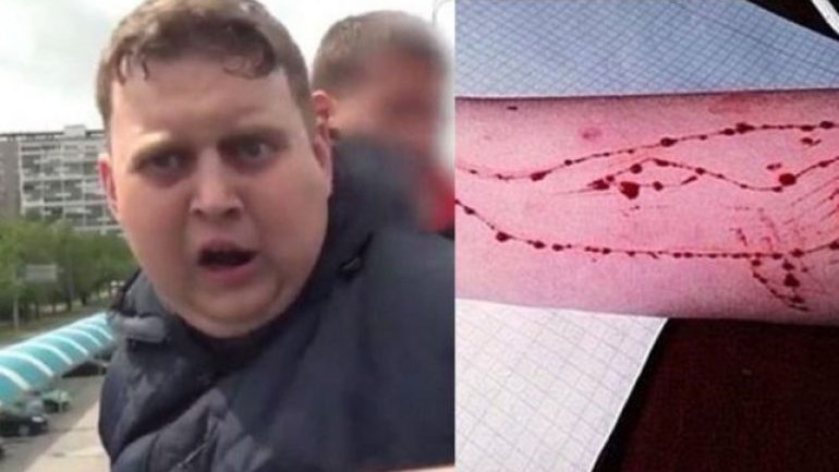 Συνελήφθη ο εμπνευστής της “Μπλε Φάλαινας” – ΒΙΝΤΕΟ