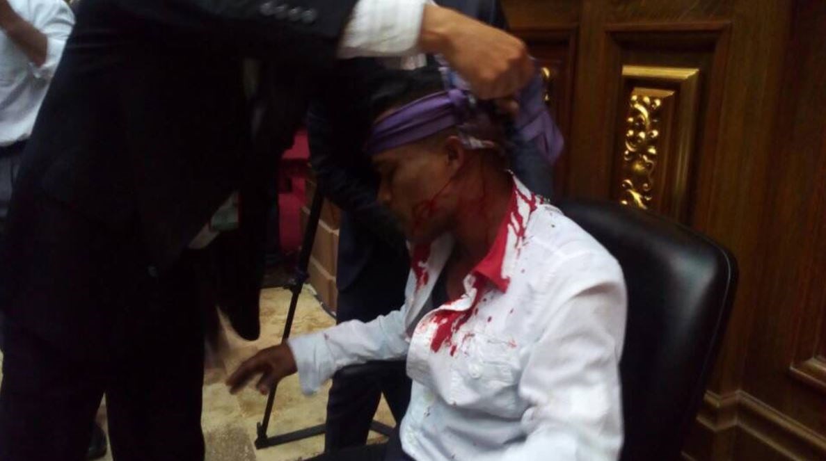 Χάος στη Βουλή της Βενεζουέλας- Υποστηρικτές του Μαδούρο χτύπησαν με ρόπαλα βουλευτές – ΒΙΝΤΕΟ