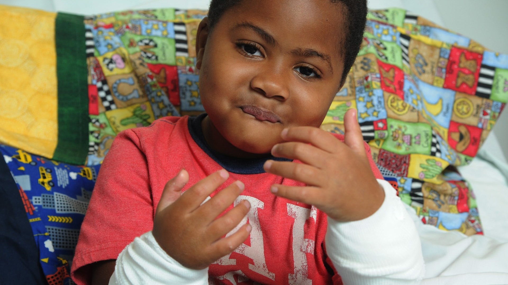 Επιτυχημένη η πρώτη διπλή μεταμόσχευση χεριών σε 10χρονο – ΦΩΤΟ