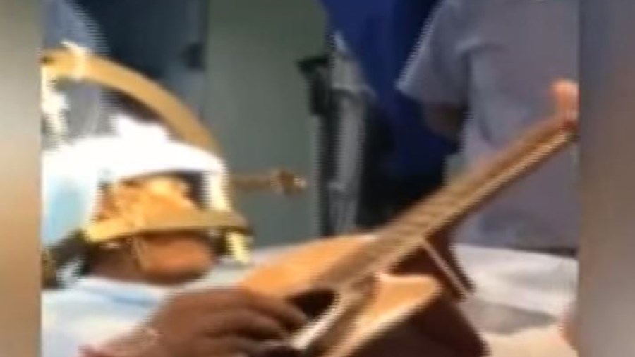 Μουσικός έπαιζε κιθάρα την ώρα που του έκαναν χειρουργική επέμβαση στον εγκέφαλο – ΒΙΝΤΕΟ – ΦΩΤΟ