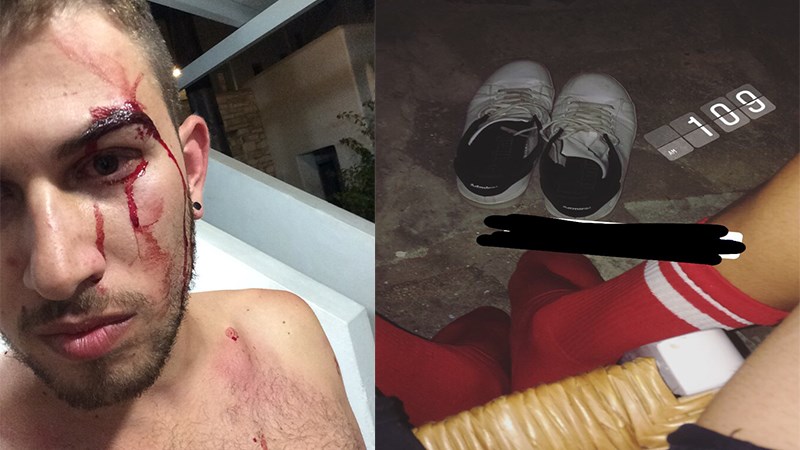 Καταγγέλλει ότι ξυλοκοπήθηκε από Ιταλούς τουρίστες στην Πάρο για το… ντύσιμό του- ΦΩΤΟ