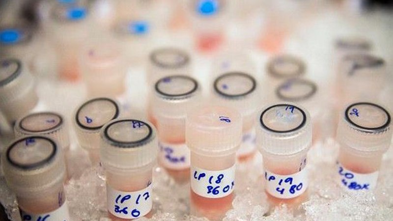 Ύποπτο δείγμα Ελληνίδας αθλήτριας που συμμετείχε στο Παγκόσμιο Πρωτάθλημα Στίβου