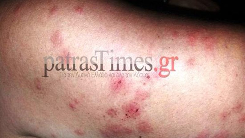 53χρονη καταγγέλλει τον ξυλοδαρμό της από αστυνομικούς – ΦΩΤΟ – ΒΙΝΤΕΟ