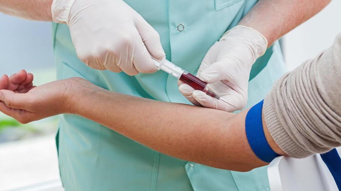 Επιστήμονες ανέπτυξαν τεστ αίματος που ανιχνεύει το DNA του όγκου σε άτομα με πρώιμο στάδιο καρκίνου