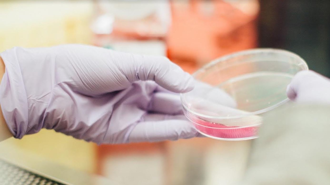 Ελληνίδα επικεφαλής σε σημαντική μελέτη που αποκαλύπτει νέα διάγνωση για τη νόσο Αλτσχάιμερ