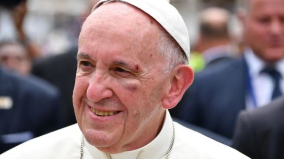 Τραυματίστηκε ο Πάπας Φραγκίσκος – ΒΙΝΤΕΟ