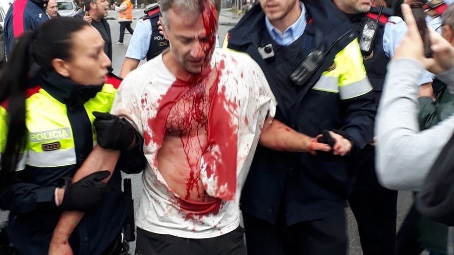 20 συγκλονιστικές φωτογραφίες από τις σκηνές βίας στο δημοψήφισμα της Καταλονίας