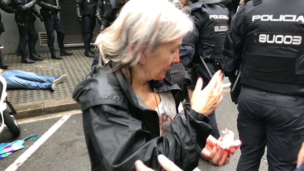 Στους 337 οι τραυματίες στην Καταλονία